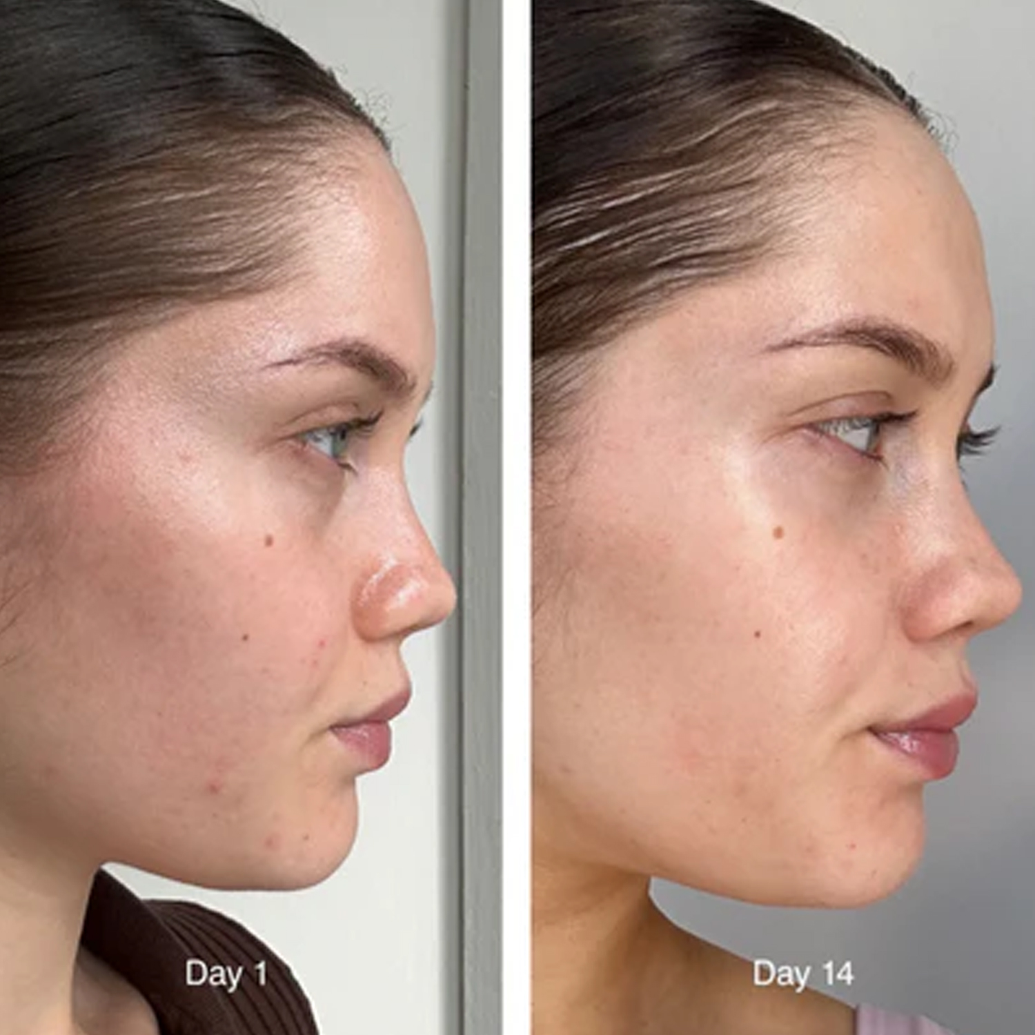 ນ້ຳນົມ GLAZING CERAMIDE FACIAL ESSENCE